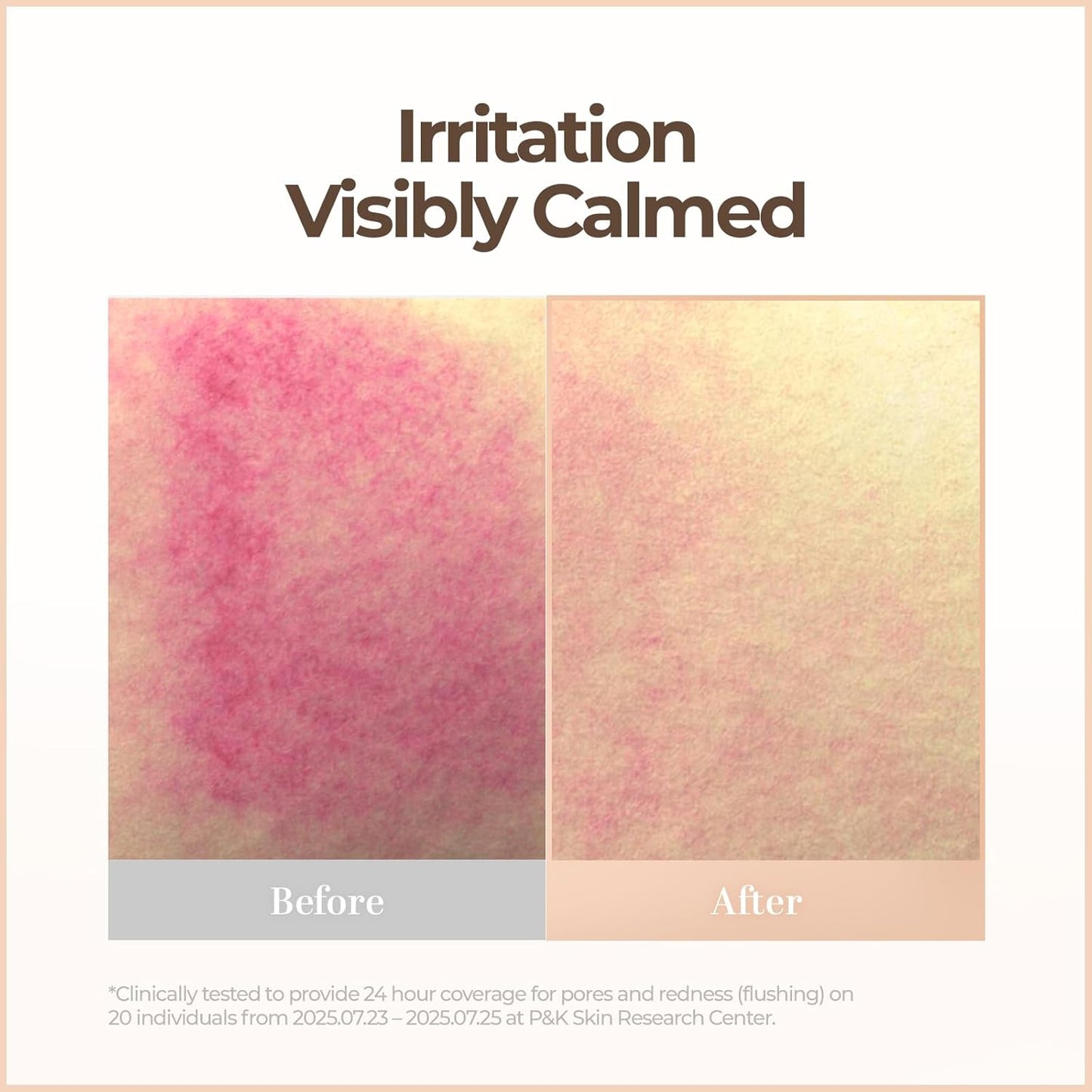 Babyglow™ Intensive Skin Blemish Balm